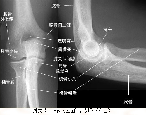 影像看片——x光线解剖(绝版收藏)