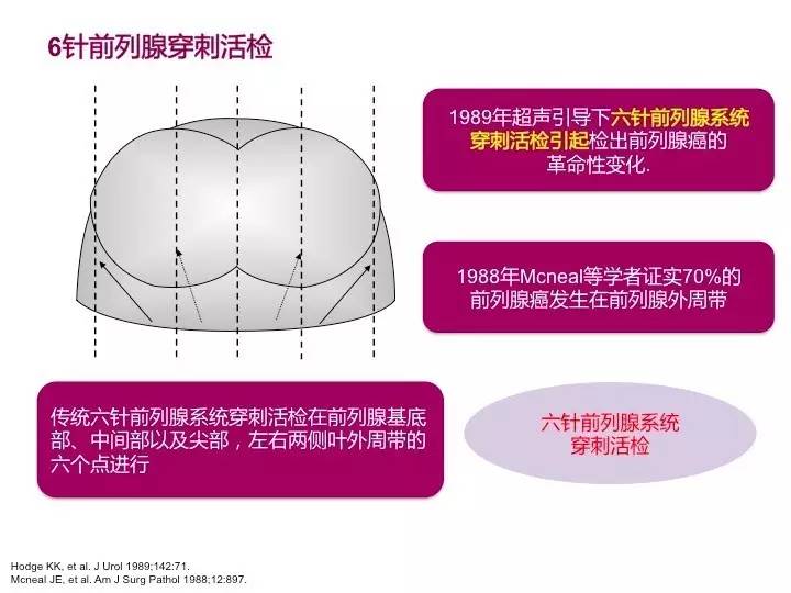 穿刺针数和部位:hodges等[19]于1989年提出前列腺6针系统穿刺法,但