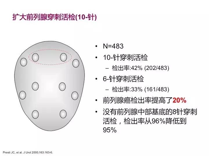 图2 常用的经会阴前列腺穿刺活检模式图 a.10针穿刺活检 b.