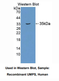 https://msimg.bioon.com/bionline/goods-no-pic.png