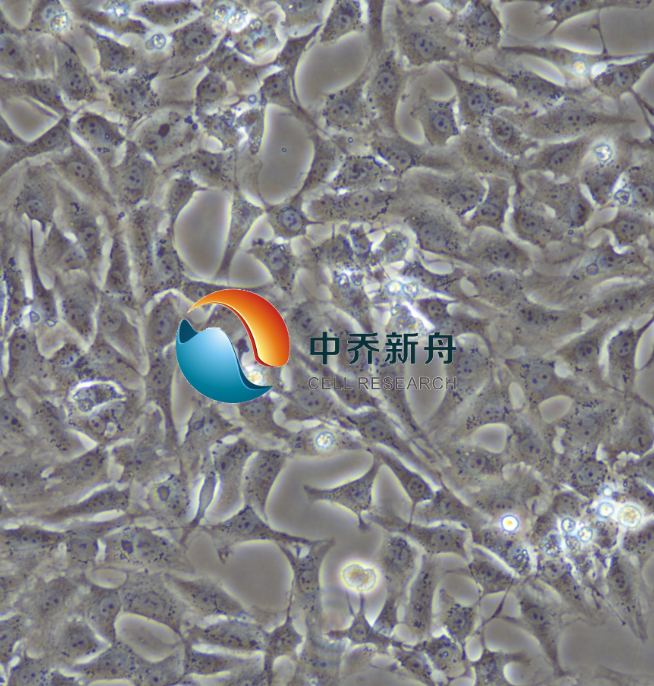 https://img.medsci.cn/8eee53bbc4cb7a98de615e72115896bc4e27fda5cbb764dbd67d9d641c2bb46a.png