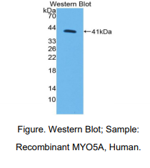 https://msimg.bioon.com/bionline/goods-no-pic.png