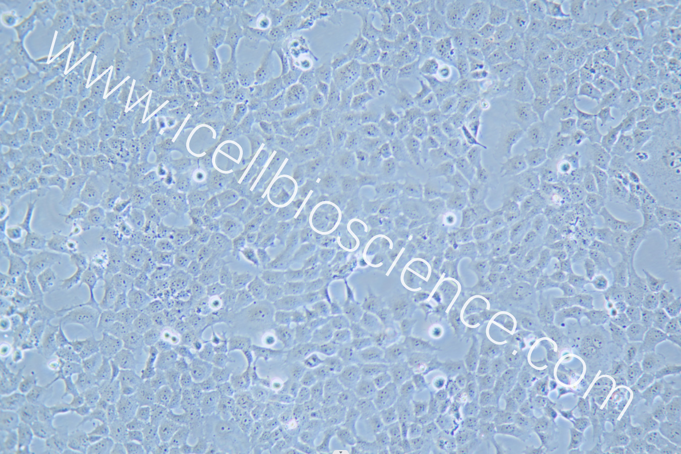 HTR-8/Svneo细胞/HTR-8-Svneo细胞/HTR-8Svneo细胞/HTR8-Svneo细胞/HTR8/Svneo细胞/人胚胎滋养细胞