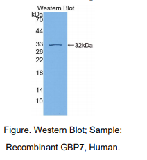 https://msimg.bioon.com/bionline/goods-no-pic.png