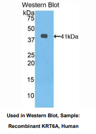 人角蛋白6A(KRT6A)多克隆抗体