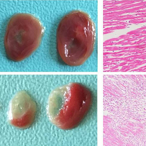 心肌梗死动物模型心脑血管模型