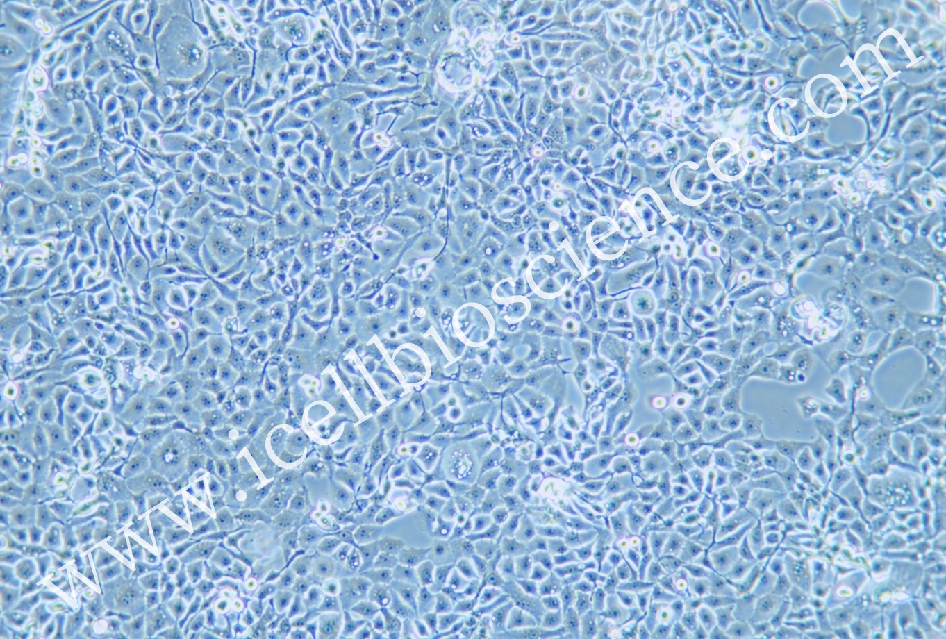 RWPE-1细胞/RWPE1细胞/RWPE-1/RWPE1/人正常前列腺上皮细胞