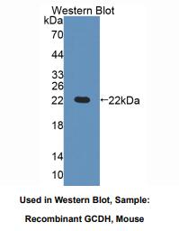 https://msimg.bioon.com/bionline/goods-no-pic.png