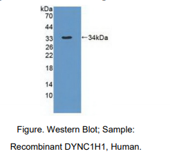 人动力蛋白胞浆1重链1(DYNC1H1)多克隆抗体