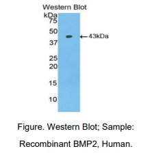 https://msimg.bioon.com/bionline/goods-no-pic.png