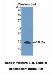 https://msimg.bioon.com/bionline/goods-no-pic.png