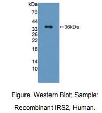 https://msimg.bioon.com/bionline/goods-no-pic.png