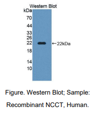 https://msimg.bioon.com/bionline/goods-no-pic.png