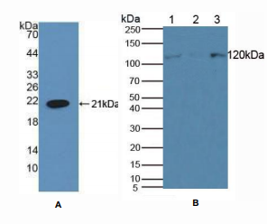 https://msimg.bioon.com/bionline/goods-no-pic.png