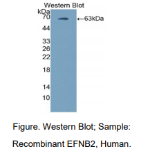 人肝配蛋白B2(EFNB2)多克隆抗体