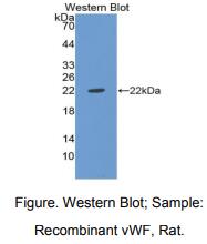 https://msimg.bioon.com/bionline/goods-no-pic.png