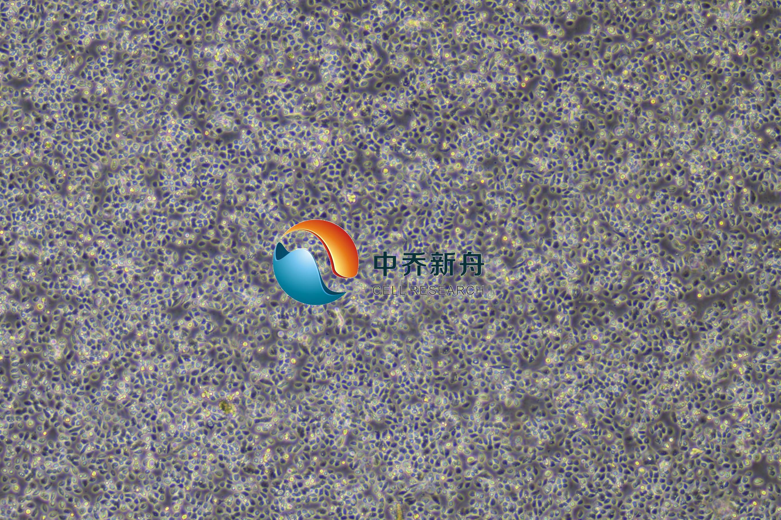 人阴道上皮细胞
