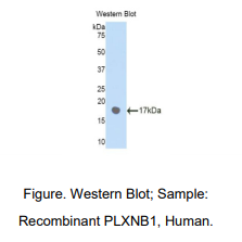 人丛状蛋白B1(PLXNB1)多克隆抗体