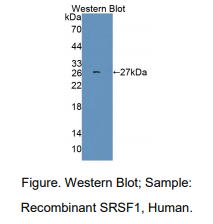 https://msimg.bioon.com/bionline/goods-no-pic.png