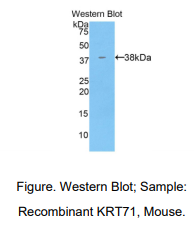 小鼠角蛋白71(KRT71)多克隆抗体