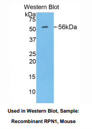 小鼠核糖体结合糖蛋白Ⅰ(RPN1)多克隆抗体