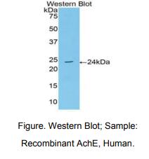 https://msimg.bioon.com/bionline/goods-no-pic.png