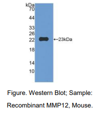 https://msimg.bioon.com/bionline/goods-no-pic.png