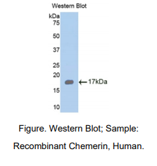 https://msimg.bioon.com/bionline/goods-no-pic.png