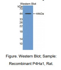 https://msimg.bioon.com/bionline/goods-no-pic.png