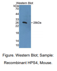 小鼠赫曼斯基普德拉克综合征蛋白4(HPS4)多克隆抗体