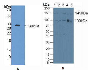 人蛋白激酶D1(PKD1)多克隆抗体