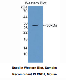 https://msimg.bioon.com/bionline/goods-no-pic.png