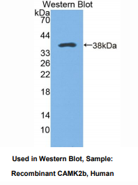 https://msimg.bioon.com/bionline/goods-no-pic.png