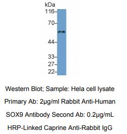 人性别决定区Y框蛋白9(SOX9)多克隆抗体