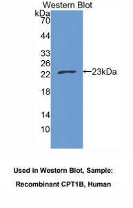 人肉毒碱棕榈酰基转移酶1B(CPT1B)多克隆抗体