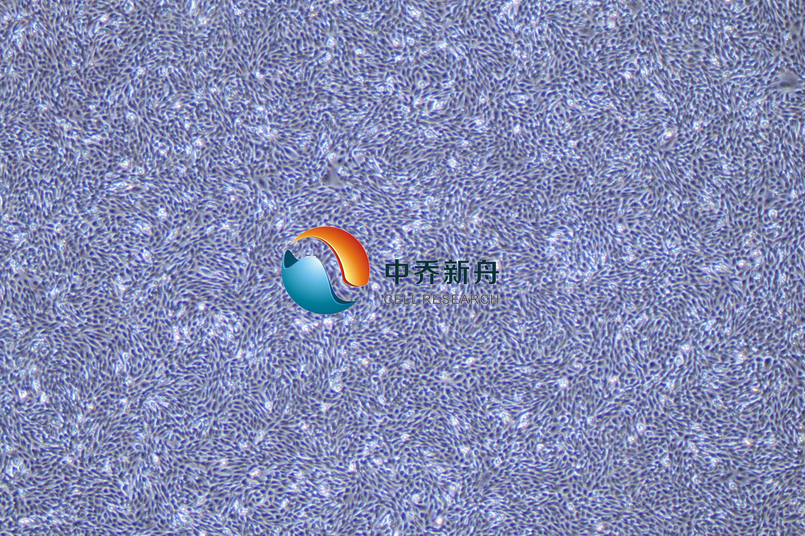 小鼠心脏微血管内皮细胞永生化