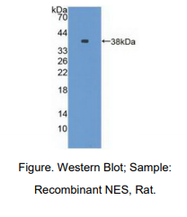 https://msimg.bioon.com/bionline/goods-no-pic.png