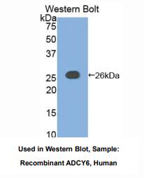 https://msimg.bioon.com/bionline/goods-no-pic.png