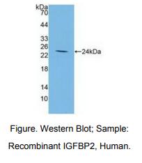 https://msimg.bioon.com/bionline/goods-no-pic.png