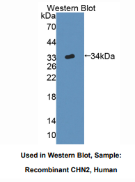 https://msimg.bioon.com/bionline/goods-no-pic.png