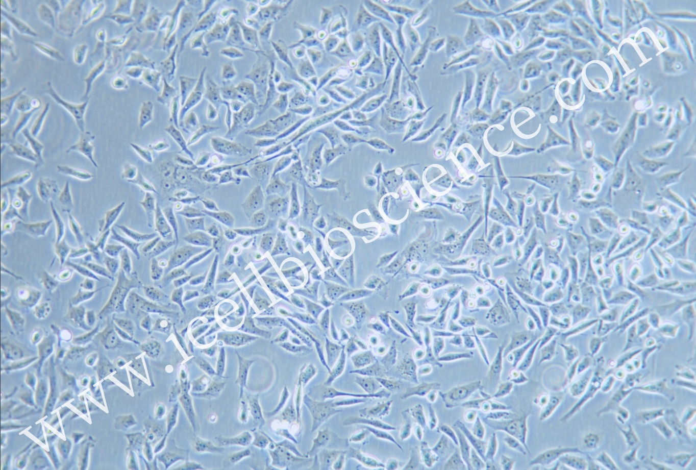 SJCRH30细胞/SJCRH-30/SJCRH30/SJCRH-30/人骨髓横纹肌肉癌细胞