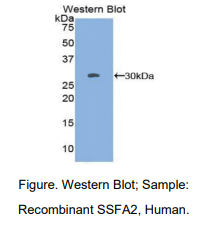 https://msimg.bioon.com/bionline/goods-no-pic.png