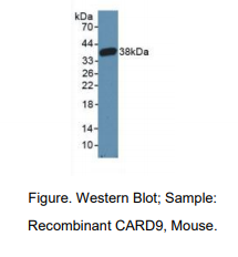 小鼠胱天蛋白酶富集域家族成员9(CARD9)多克隆抗体