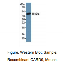 https://msimg.bioon.com/bionline/goods-no-pic.png