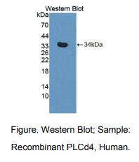 人磷酯酶Cδ4(PLCd4)多克隆抗体