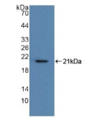 人肌球蛋白轻链2(MYL2)多克隆抗体