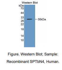 https://msimg.bioon.com/bionline/goods-no-pic.png