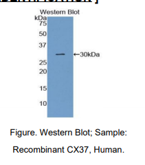 https://msimg.bioon.com/bionline/goods-no-pic.png