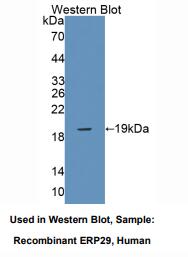 https://msimg.bioon.com/bionline/goods-no-pic.png