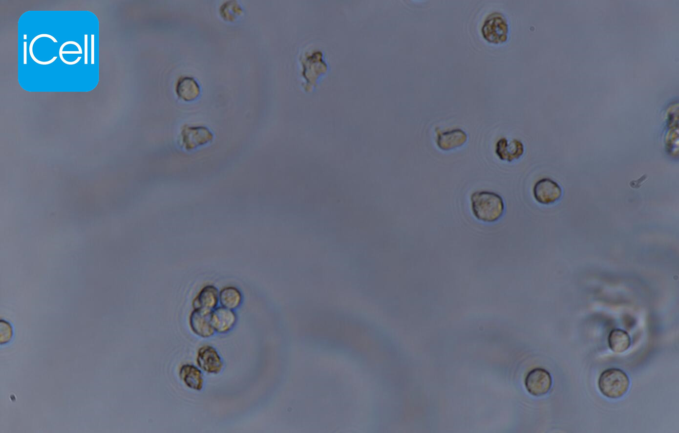 https://img.medsci.cn/5f561f9d1966c8a40c069b97fcac23b82666d7612246dbae75064de0bed04333.png